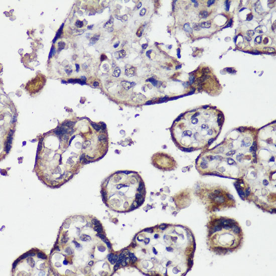 A16673_IHC_01_(900004).jpg